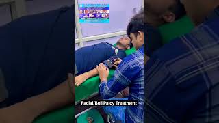Bellfacial Palcy Treatment .