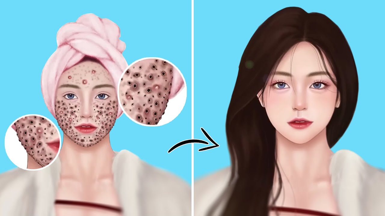 ASMR Huge Acne & Black Head Pimple Removal Animation Acne Deep
