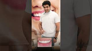Smile Makeover Magic ✨Transform Your Smile, Transform Your Confidence!