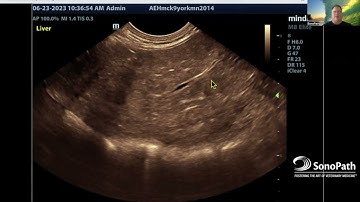 Image Optimization: Enhancing Resolution in Heterogenous Tissue [5 SonoMinutes with SonoPath Ep.11]