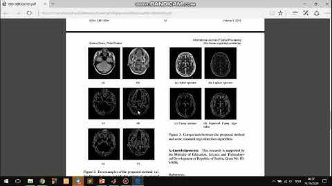 Segmentasi Citra Dengan Deteksi Tepi Canny Segmentasi DeteksiTepiCanny