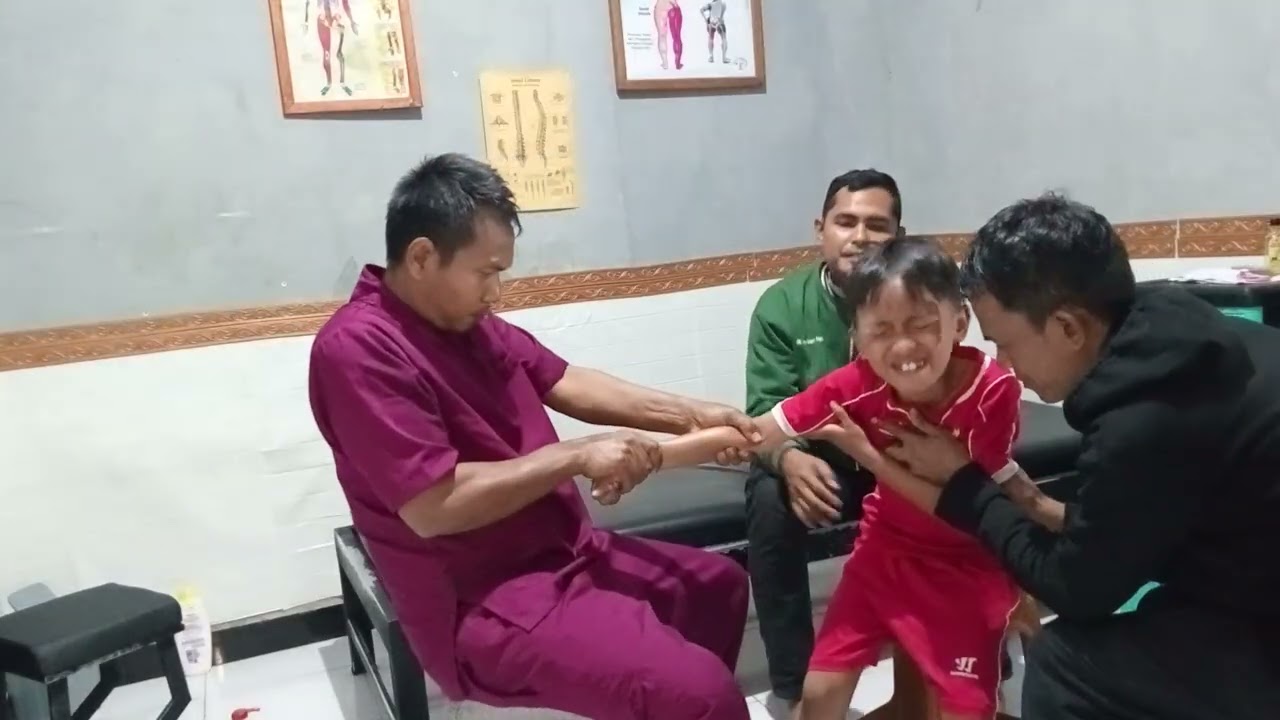 Bocil retak tulang lengan hitungan menit langsung teratasi 
