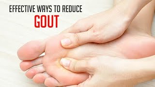 CURE for GOUT? How to Prevent GOUT? 10 Natural HOME Remedies for Gout Relief. HOW to Cure Gout FAST?