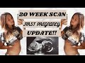 20 Week Anomaly Scan and First Pregnancy Update | Teen Mum |