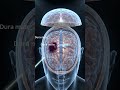 Operation Theater Brain Surgery | Craniotomy Procedure for Brain Clot