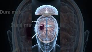 Operation Theater Brain Surgery | Craniotomy Procedure for Brain Clot