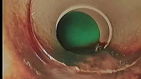Fulin Shen Scope-Drain Lines-9350 SE 47th St.