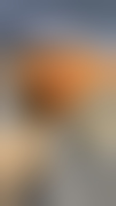Silicone Breast Implant Rupture Discovered During Breast Augmentation Surgery