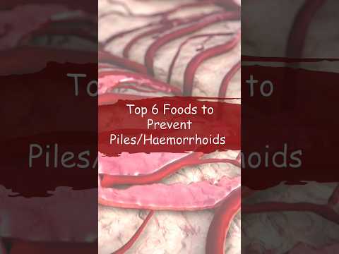 Top 6 Foods