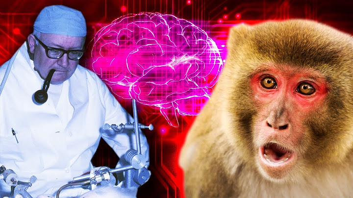 ‘Dr. Butcher’ Dreamed of Doing Head Transplants