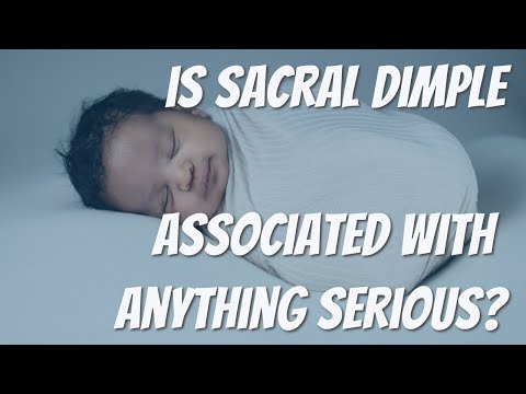 IS SACRAL DIMPLE EVER ASSOCIATED WITH MORE SERIOUS CONDITIONS?