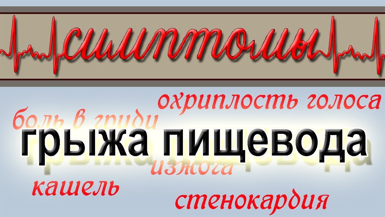 ГРЫЖА ПИЩЕВОДА.СИМПТОМЫ. Боль в груди, стенокардия, кашель... - YouTube