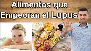 ¿Qué alimentos desencadenan el lupus?