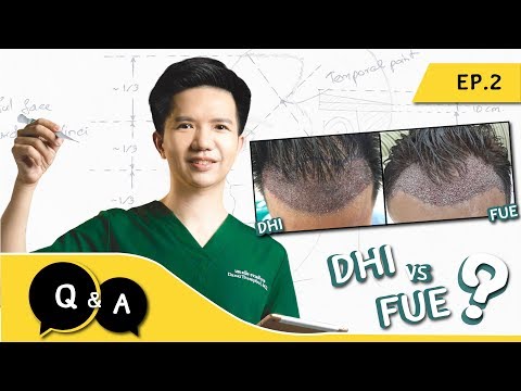 DHI vs FUE ปลูกผมวิธีไหนดี? | Q&A Episode 2