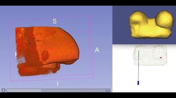 Needle Insertion Modeling and Simulation in breast intervention