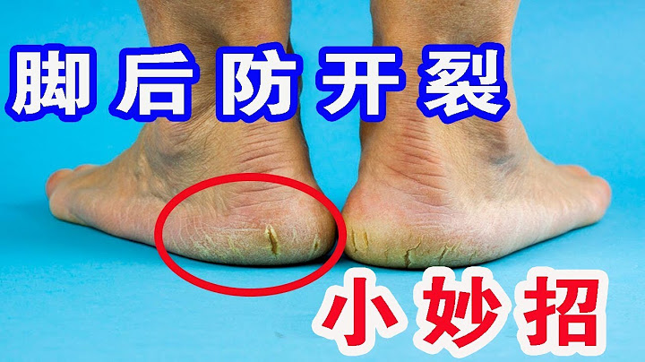 【生活小妙招】腳後跟開裂脫皮不用怕，教你一個土方法，輕鬆解決，好用又省錢【生活小幫手安姐】