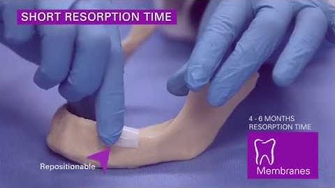 Collagen Matrix - Dental Membranes - MatrixMem™ - Product Demo