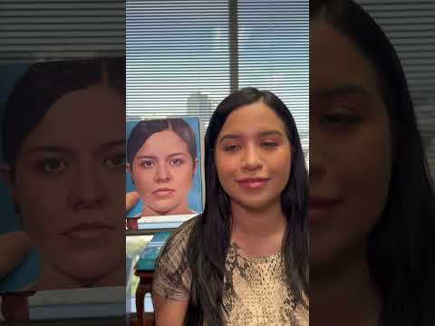 Video thumbnail: Long-term Results  Matter-Rhinoplasty! · Rod J. Rohrich, M.D. Plastic Surgeon