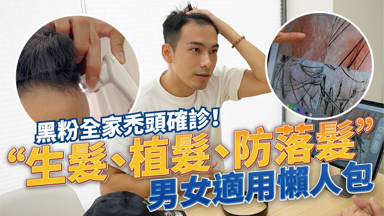 如何改善禿頭與掉髮危機！生髮、防落髮、植髮知識大補帖！【雅各Jacob】