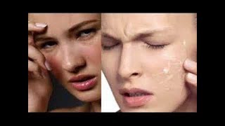 Ternyata INILAH 7 Ciri Ciri Tidak Cocok Memakai Cream Wajah Pemutih Wajah