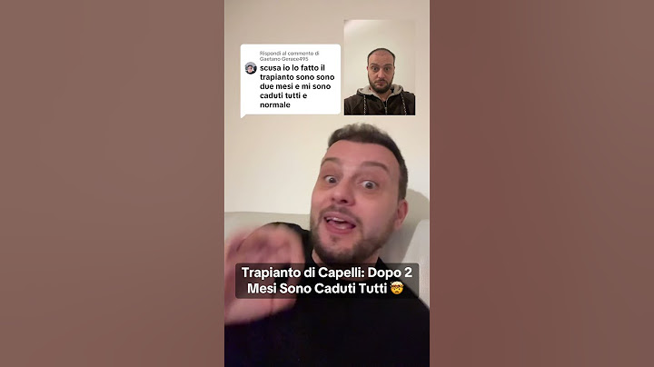 Trapianto di Capelli: Dopo 2 Mesi Sono Caduti Tutti 🤯😭 #trapianto