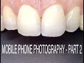 MOBILE DENTAL PHOTOGRAPHY - Part 2