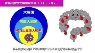 食中毒啓発ファイル　Ｆｉｌｅ6 腸管出血性大腸菌食中毒（Ｏ１５７など）