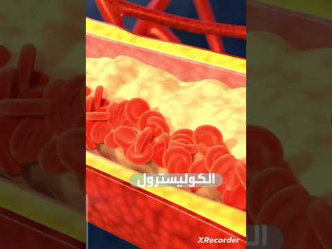 علامة صامتة تدل على ارتفاع الكولسترول في دمك تعرف عليها