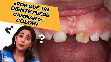 ¿Por qué los dientes de mi hijo parecen GRISES?