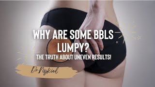 Why Are Some BBLs Lumpy? The Truth About Uneven Results! | Dr.Nykiel