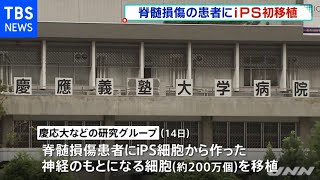 世界初 慶大などが脊髄損傷の治療にｉＰＳ由来の細胞を移植