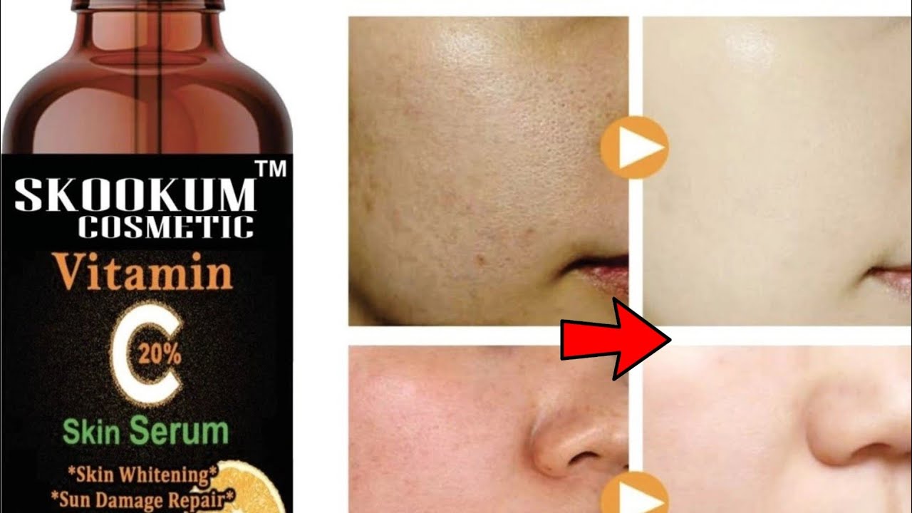 mizon first essence watson