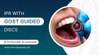 How to Properly Use GOST Discs for IPR - Strauss Diamond How to Properly Use GOST Discs for IPR - Strauss Diamond