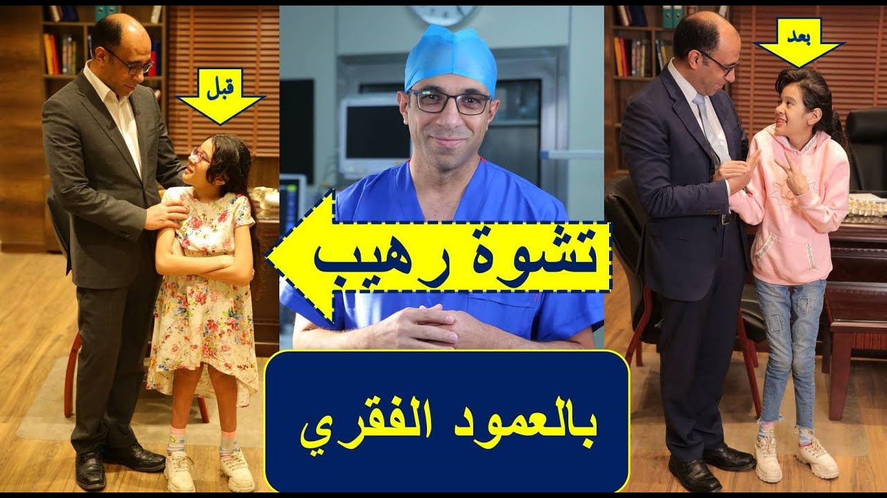 تغير جذري في حياة الطفلة هنا بعد احد اخطر جراحات تصليح اعوجاج و تحدب العمود الفقري