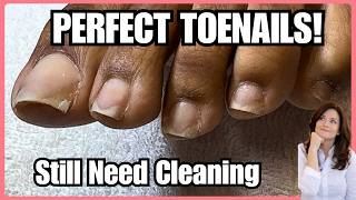 She Already Had Perfect Toenails…Then We Added the Pink Polish