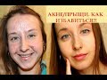 Как избавиться от акне (прыщей) НАВСЕГДА | Моя история, советы.