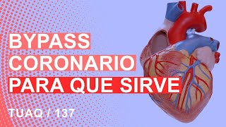 Para Qu Sirve Un bypass qu Es Un Baypass En El Corazn