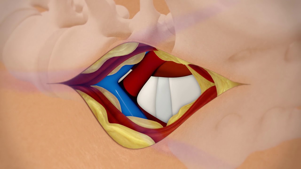 Spine OLIF 51 Animation Video