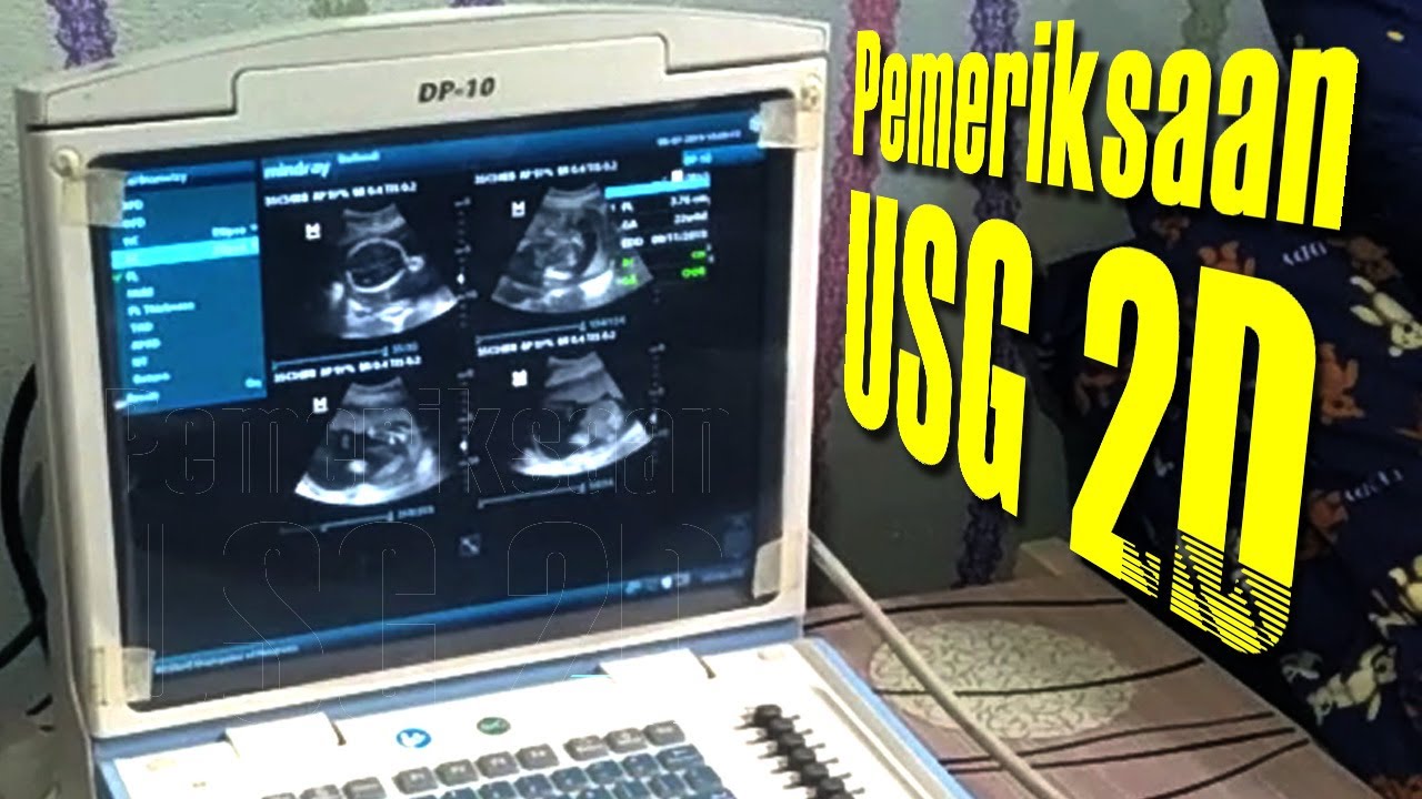 USG 2 dimensi akurat dan murah banget - YouTube