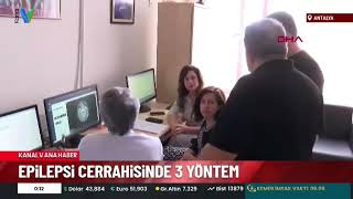 Epilepsi Ile Mücadele Eden 3 Hasta, Nöbetsiz Yaşama Kavuştu