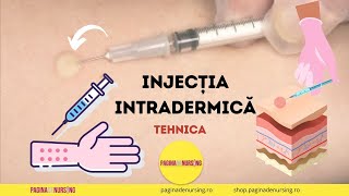 Injecția intradermică (Tehnica AMG)