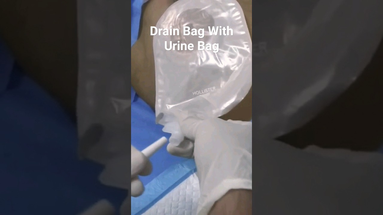 Drain Bag Connect With Urine Bag 
