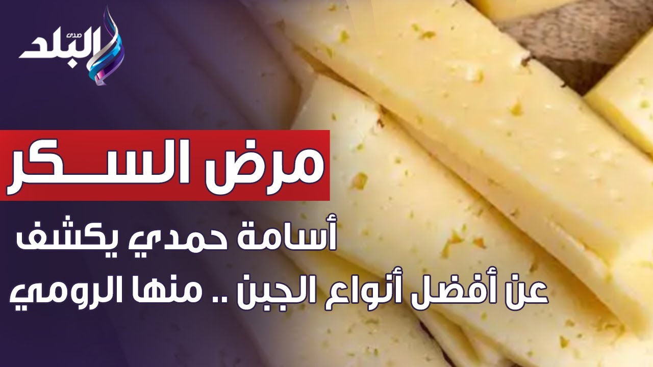 الدكتور أسامة حمدي يكشف عن أفضل أنواع الجبن لمرضى السكر.. منها الرومي