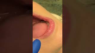 Details Uncovering Oral Cavity Surprises: What You Didn't Know! #NBDHE #DentalHygieneBoards Guide