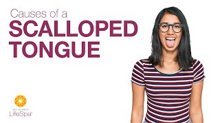 Causes of a Scalloped Tongue | Dr. John Douillard's LifeSpa