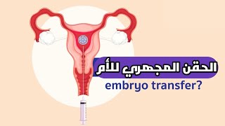 شاهد الحقن المجهري للأم خطوة بخطوة_ICSI 3D video - Intra Cytoplasmic Sperm Injection - Steps