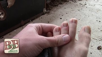 Barefoot Winter Walk Gave Me Chilblains (Frostbite Light) | Back to Basics Show