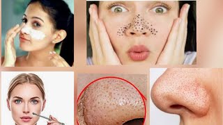 black head remove Kare 5 minut mein part 8 by Nidhi Sharma screenshot 3
