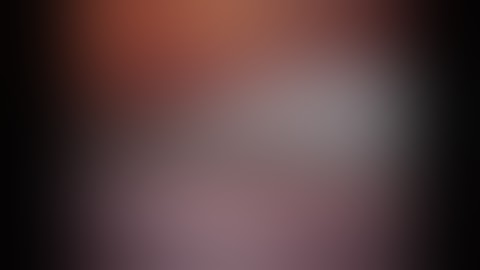 Robotic transabdominal retromuscular umbilical prosthetic hernia repair (TARUP)