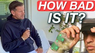 Alcaraz Pulls Out of Wimbledon | How Bad is His Wrist Injury?